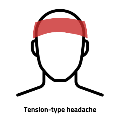 Diagram of tension-type headache pain in a band across the forehead
